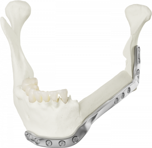 AccuPlate 